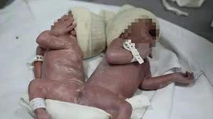 Divulgação / Hospital do Rocio