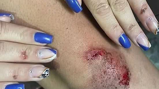 Passageira pula de carro após ser assediada por motorista de app | Reprodução / TV Globo