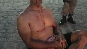 Ciclista sobreviveu após reagir ao assalto | Cortesia ao TNH1