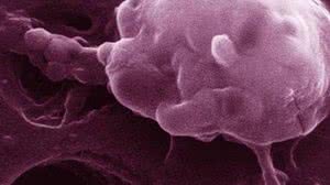 Célula cancerosa | US National Cancer Institute/Reprodução