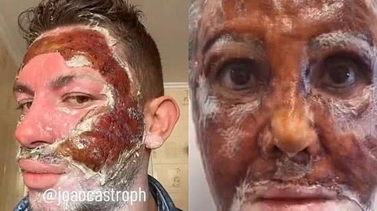 Foto: Reprodução/Redes Sociais