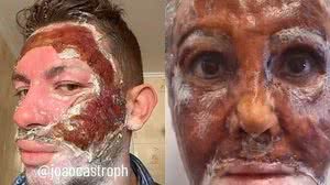 Foto: Reprodução/Redes Sociais