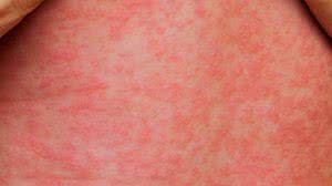 Foto: Ministério da Saúde