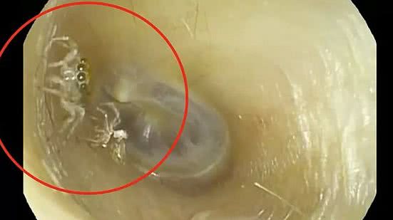 Reprodução / The News England Journal of Medicine