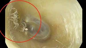 Reprodução / The News England Journal of Medicine