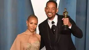 Imagem Alopecia: o que é a condição capilar que motivou agressão de Will Smith a Chris Rock