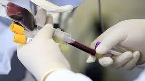 Foto: Reprodução/Agência Brasil