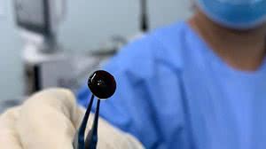 Imagem Você sabe o que é Catarata Nigra?