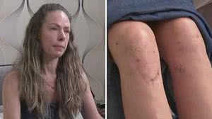 Mulher denunciou médico por cirurgia | Divulgação