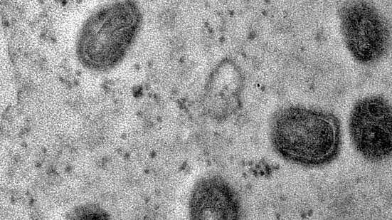 © Débora F. Barreto-Vieira/IOC/Fiocruz