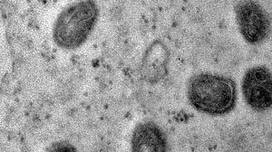 © Débora F. Barreto-Vieira/IOC/Fiocruz