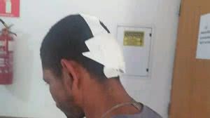 Trabalho análogo à escravidão é descoberto após empregado sobreviver a tiro | Foto: Divulgação/MPT-MA