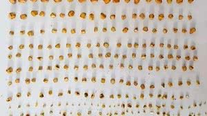 Ludmila Lourenço sentia dores na coluna há três anos e mesmo indo ao médico com frequência, ninguém havia identificados as pedras | Foto: Reprodução/Arquivo Pessoal