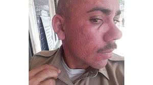 Cristiano Manoel dos Santos foi atendido na UPA depois da ocorrência e chegou a passar mal | Arquivo pessoal