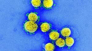 Total de mortes na pandemia chegou a 618.424 | Foto: Instituto Nacional de Alergia e Doenças Infecciosas