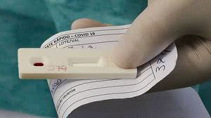 Imagem Covid-19: Brasil registra 69,1 mil mortes e 1,75 milhão de casos