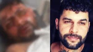 Foto: Reprodução/Redes Sociais