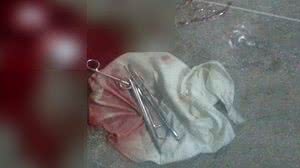 Instrumentos usados no parto em que bebê teria caído no chão, no Hospital de Ubajara, no Ceará. | Arquivo Pessoal