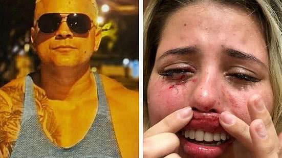 Imagem Influenciadora denuncia o namorado 'Bambam' por agressão e cárcere privado, no Rio