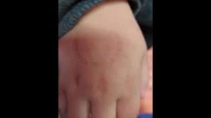 Imagem Diretora de escola é suspeita de morder aluno de 4 anos: 'não mordi forte'