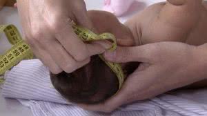 Imagem Especialistas levam ao Senado dados sobre impacto da zika em bebês