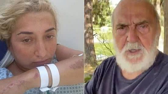 Imagem Mulher atropelada por Lima Duarte quebra cinco ossos e confronta versão de ator para acidente