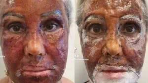 Foto: Reprodução/Redes Sociais