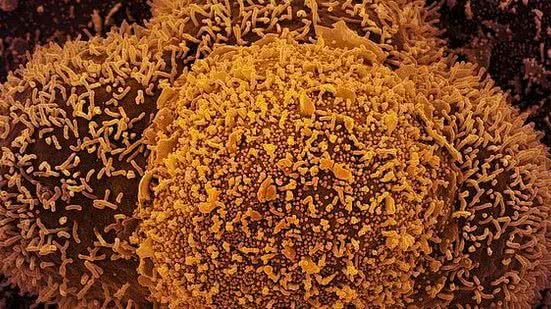 Foto: Reprodução/Agência Brasil