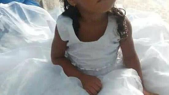 Criança de dois anos foi internada após quadro de perda de visão | Reprodução / Redes Sociais