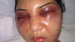 Esposa ficou desfigurada após agressão | Arquivo Pessoal