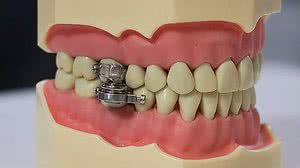 Divulgação / Universidade de Otago