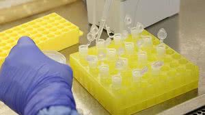 Imagem Anvisa aprova três novos testes para diagnóstico do novo coronavírus