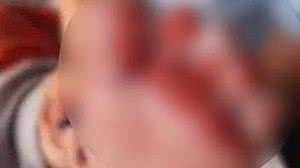 Imagem Bebê sofre queimaduras durante banho em creche de SC