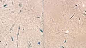 Resultados de experimentos feitos em células cerebrais humanas sugerem que o medicamento retarda o envelhecimento celular | Divulgação