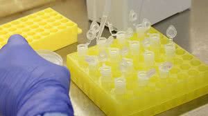 Foto: Divulgação / Fiocruz