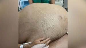 Foto: Reprodução/Arquivo Pessoal