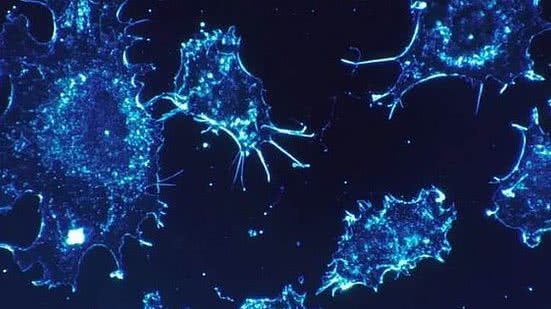 Células de câncer | Pixabay