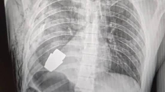 Foto: Reprodução/Redes Sociais