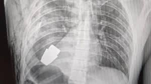 Foto: Reprodução/Redes Sociais