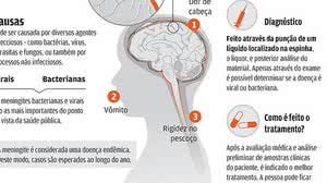 Meningite | Foto: Luciana Pimenta / Infografia O POVO