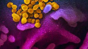 NIAID / Reprodução