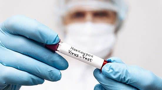 Foto: Reprodução/Shutterstock