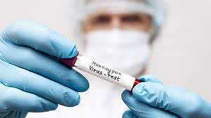 Foto: Reprodução/Shutterstock