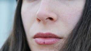 Clima seco do inverno pode causar rachaduras nos lábios | Foto: Reprodução/Pixabay