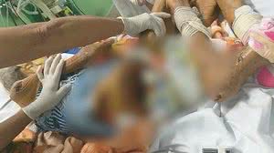 Idosa apresentava feridas na pele | Imagens cedidas pelo MP/Maranhão