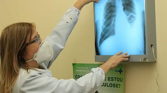 Eduardo Gomes / OLMD / Fiocruz Amazônia