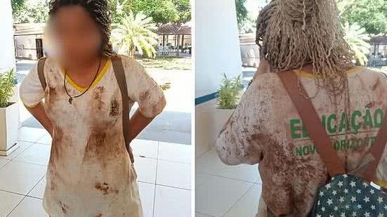 Menina, de 12 anos, foi agredida em escola municipal em Novo Horizonte (SP) — Foto: Arquivo pessoal