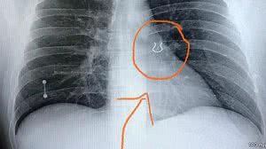 Foto: Reprodução/Redes Sociais