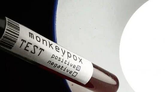 Imagem Monkeypox: número de casos suspeitos em investigação sobe para 89