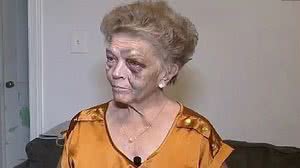 O homem desferiu socos no rosto da mulher, que ficou ensanguentada e com graves lesões | Foto: Reprodução/Redes Sociais